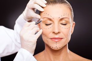 Face-Lift-Rhytidectomy-121615-09